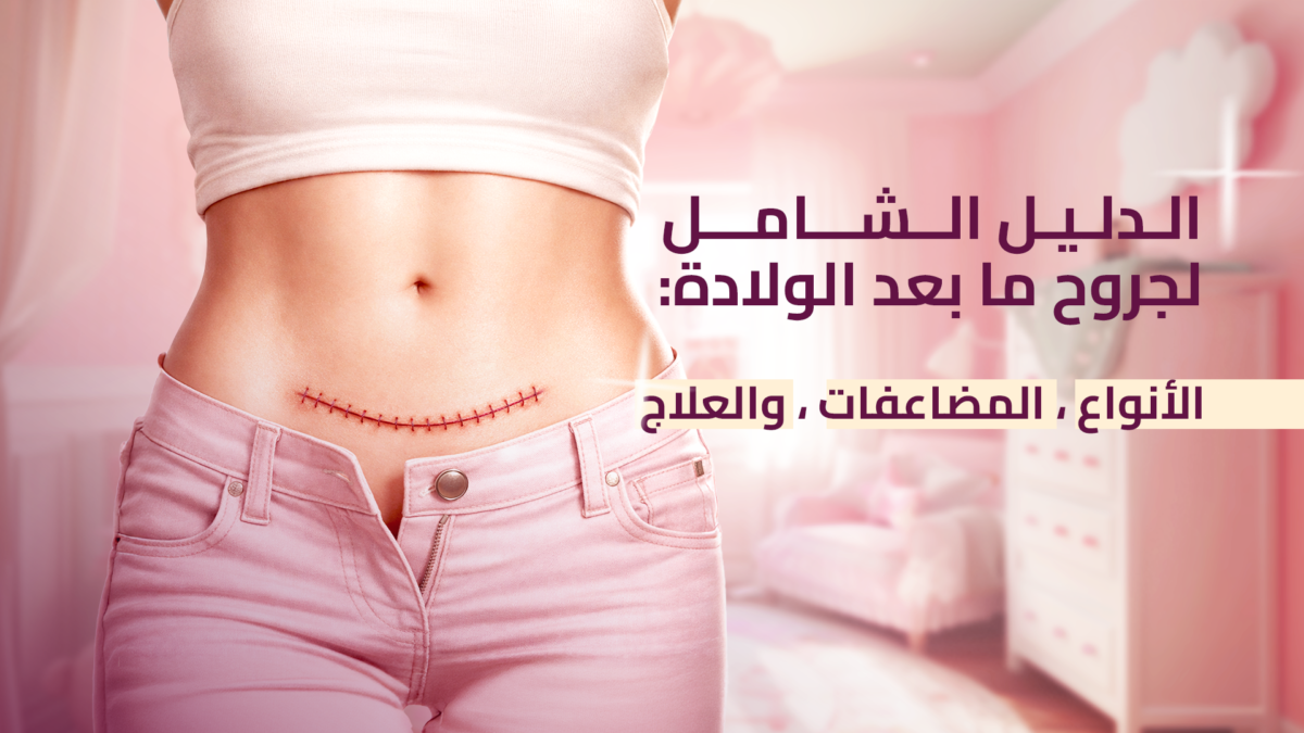 الدليل-الشامل-لجروح-ما-بعد-الولادة-الأنواع-المضاعفات-والعلاج-copy-1200x675.png